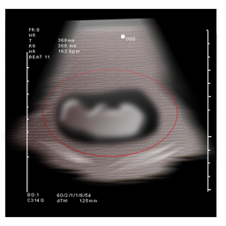 obstetrics icon